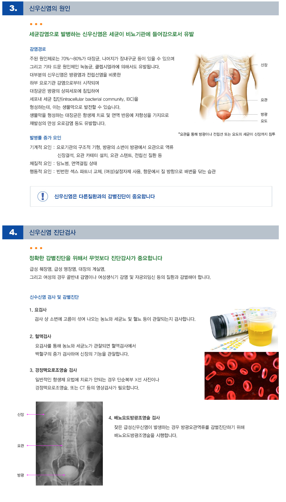 요로계 감염